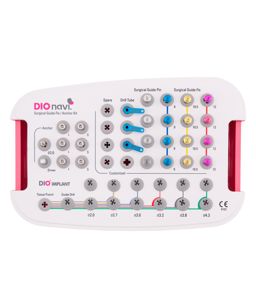 DIOnavi. Surgical Guide Fix / Anchor Kit.